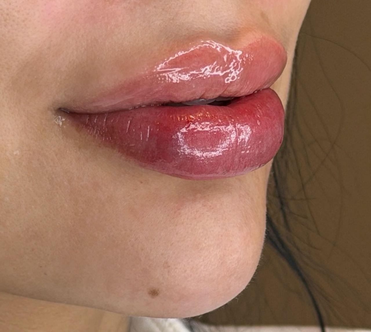 Närbild på naturligt fylliga läppar efter behandling hos Beauty IQ
